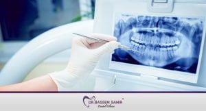 مشاكل الأسنان وعلاجها بالتكنولوجيا الحديثة