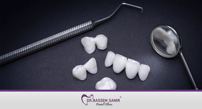 سعر عدسات الاسنان في مصر