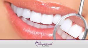 تبييض الاسنان وافضل طريقة لتبييض الاسنان