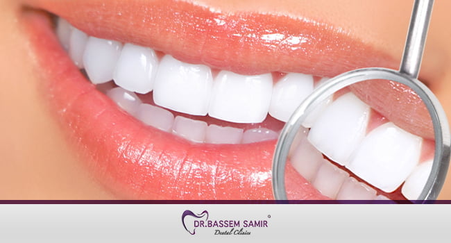 تبييض الاسنان وافضل طريقة لتبييض الاسنان