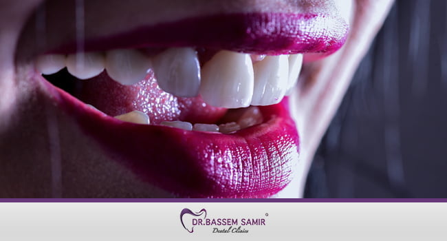 هوليود سمايل