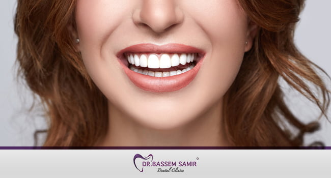 افضل طرق تجميل الاسنان