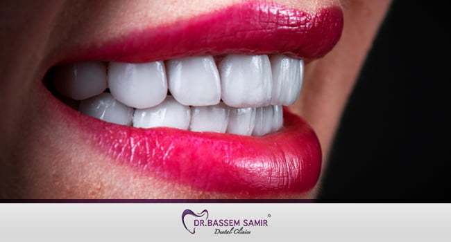 ابتسامة هوليود في مصر