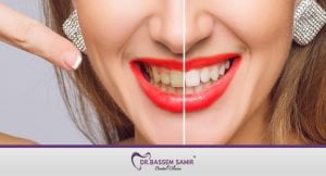 هوليود-قبل-وبعد