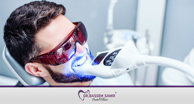 نصائح بعد تبييض الاسنان بالليزر
