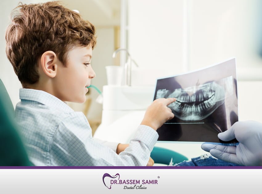 علاج الاسنان للاطفال 1