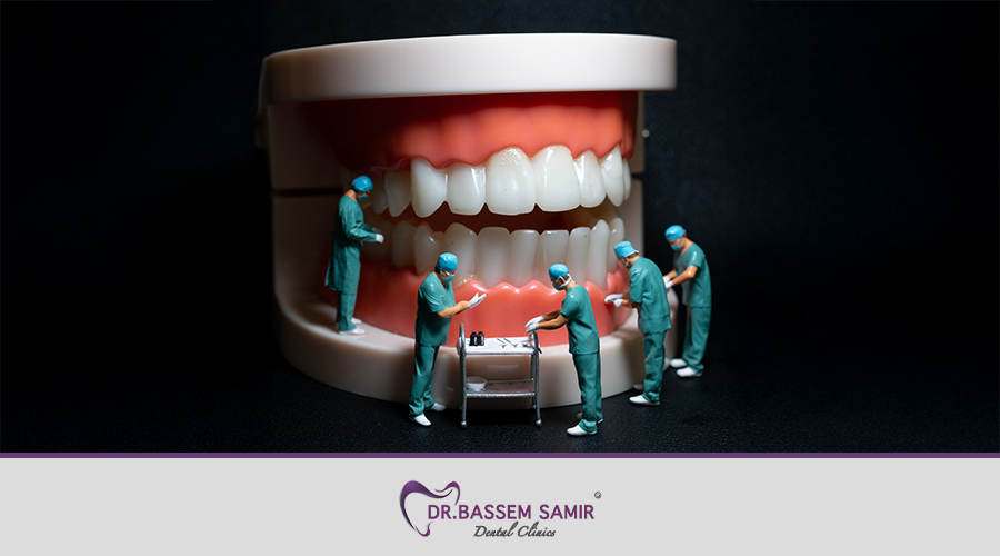 خطوات زراعة الاسنان