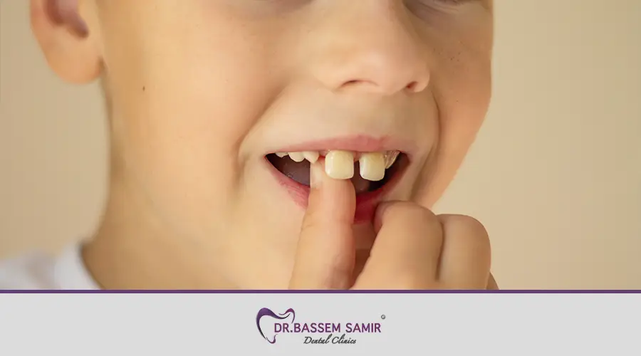 اسباب اصفرار اسنان الاطفال